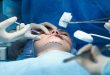 The Importance of Emotional Preparedness Before Undergoing Plastic Surgery